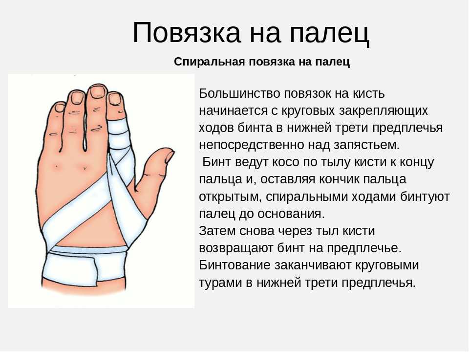 Как перевязать палец на руке