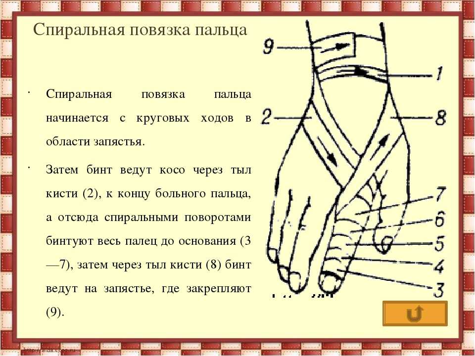 Схема перевязки пальца. Схема перевязки руки бинтом. Схема перевязки кисти. Почему повязка на ноге.